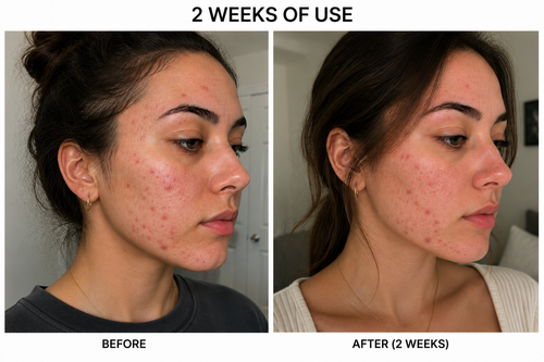 Clearer, brighter skin
